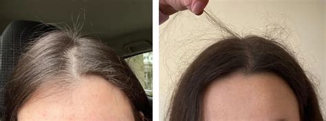 Hair breakage on top of head. Things To Know About Hair breakage on top of head. 